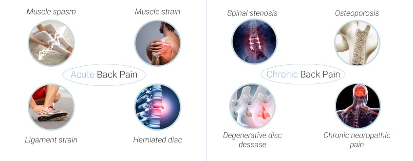 Common Causes and Types of Back Pain