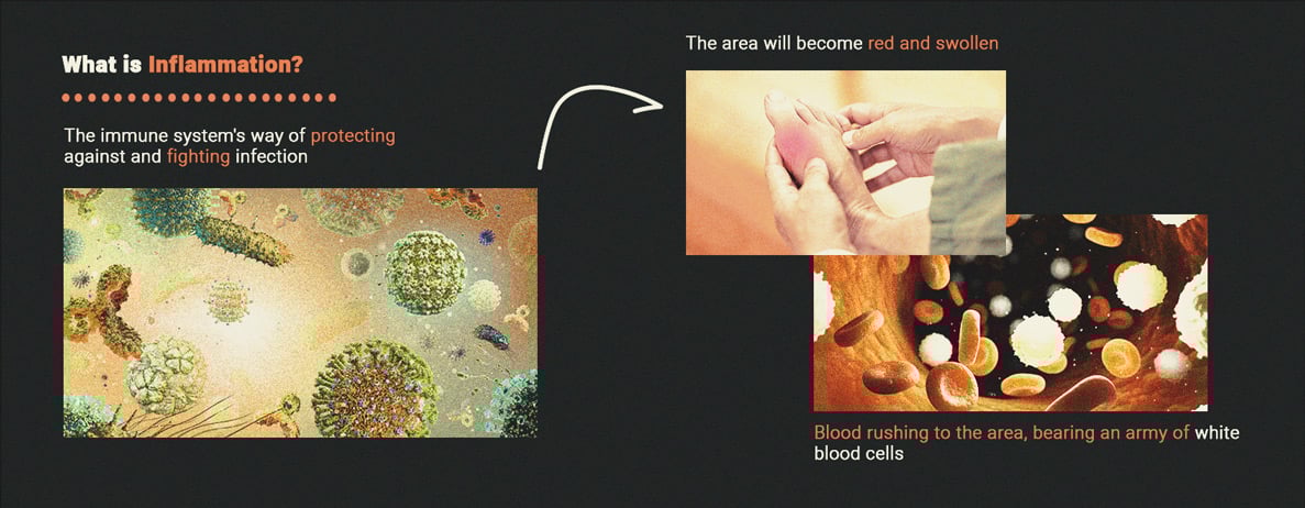 Cannabis and Inflammation: What's the Relationship? Cannabis and Inflammation: What's the Relationship?