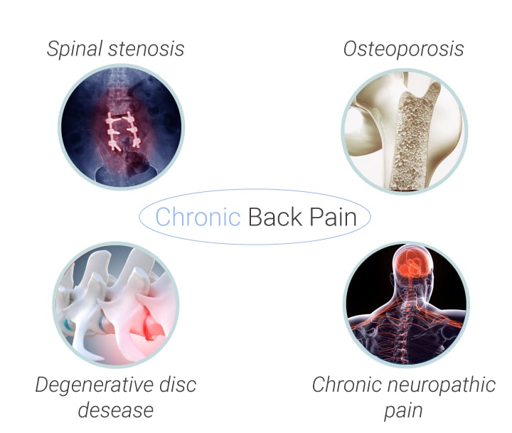 Common Causes and Types of Back Pain