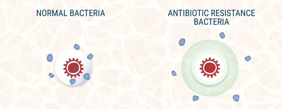 Normal Bacteria and Resistant Bacteria