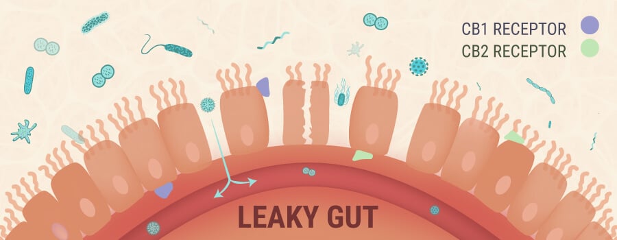 Leaky Gut 