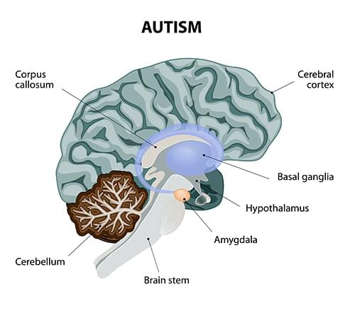 cannabis and autism