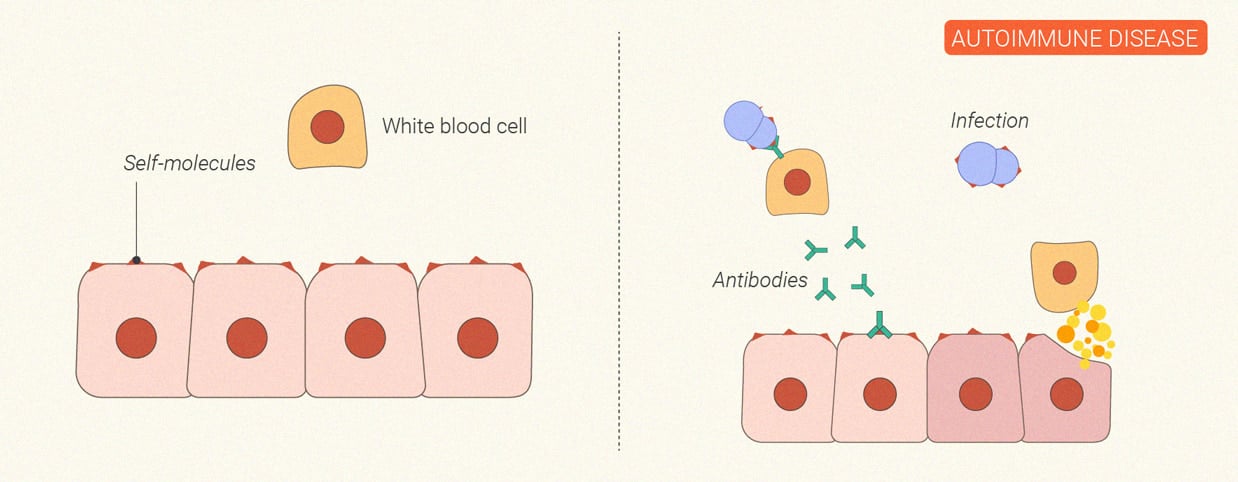 How Does Cannabis Affect the Immune System?