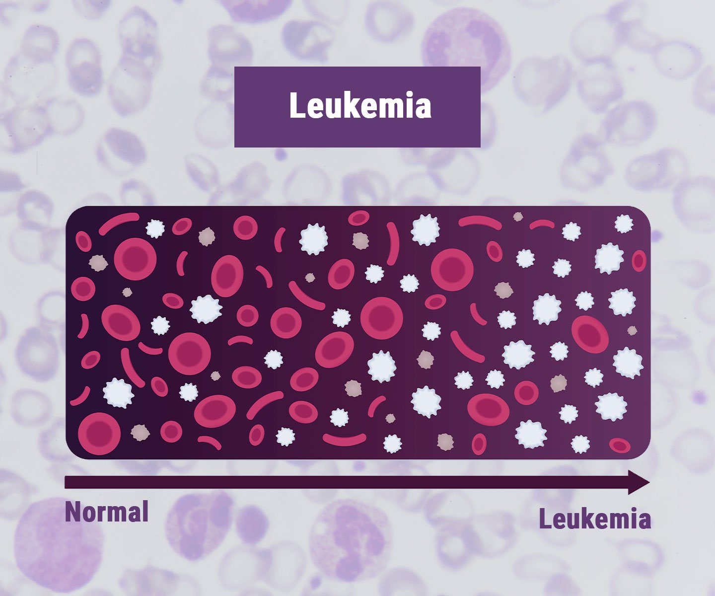 Ongoing Studies on Marijuana and Cancer