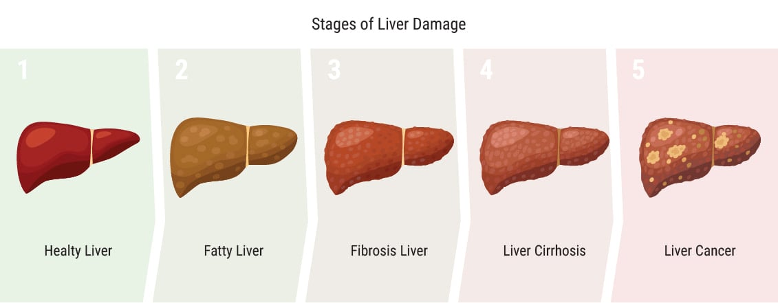 Does Cannabis Affect the Liver?