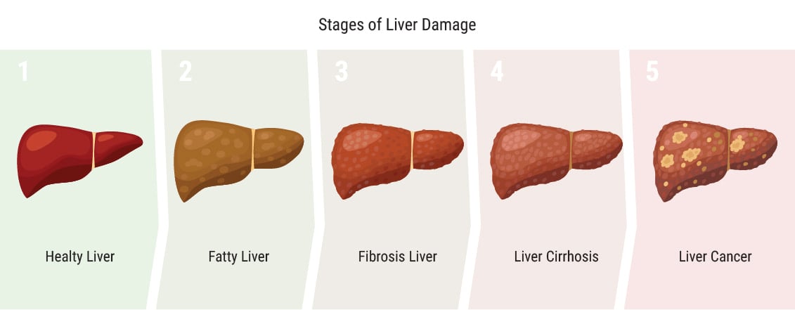 Does Cannabis Affect the Liver? Does Cannabis Affect the Liver?