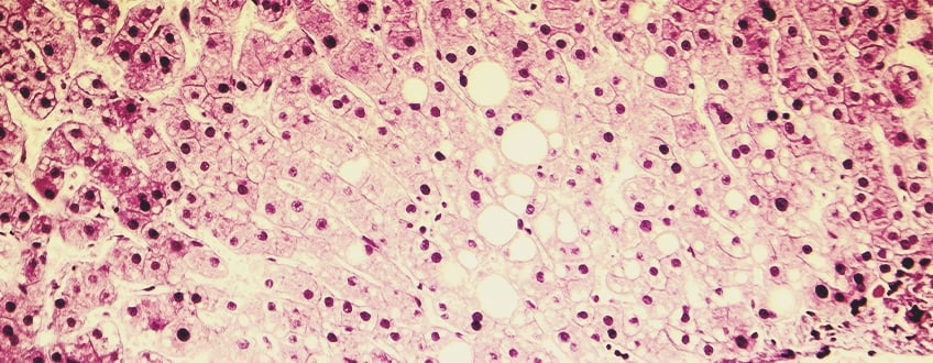 What Are Common Liver Problems? What Are Common Liver Problems?