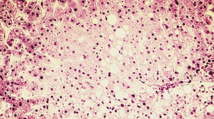 What Are Common Liver Problems? What Are Common Liver Problems?