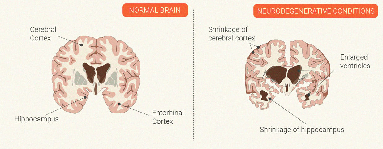 How Does Cannabis Affect the Immune System?