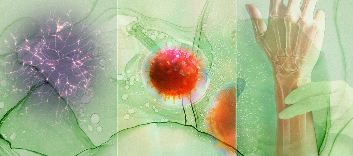 Farnesene: A Little-Known Cannabis Terpene Farnesene: A Little-Known Cannabis Terpene