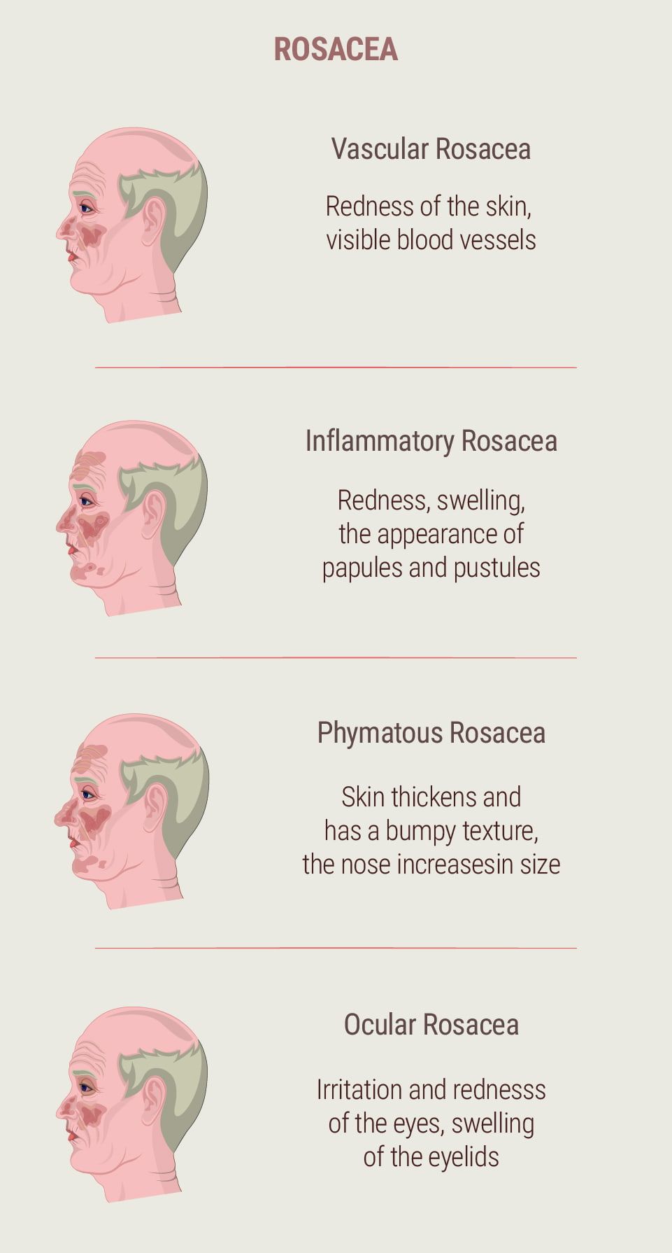 What Is Rosacea?