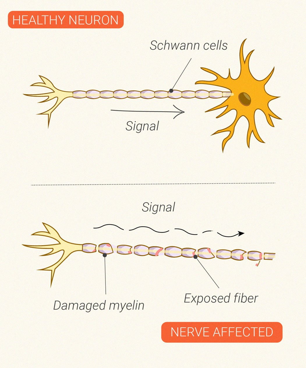 How Does Cannabis Affect the Immune System? How Does Cannabis Affect the Immune System?