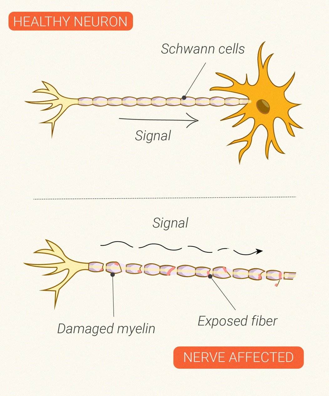 How Does Cannabis Affect the Immune System?