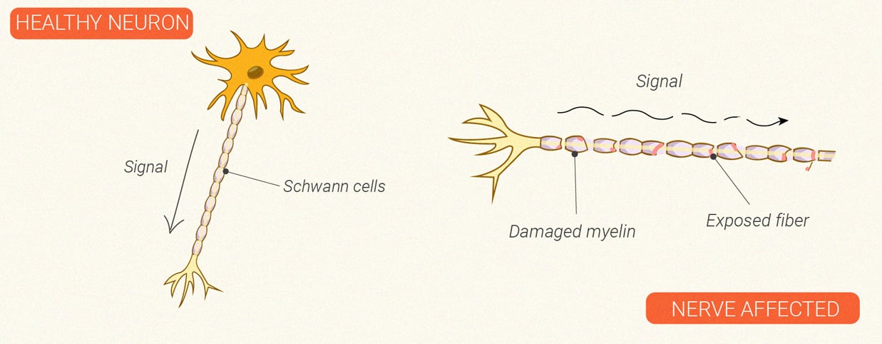 How Does Cannabis Affect the Immune System?