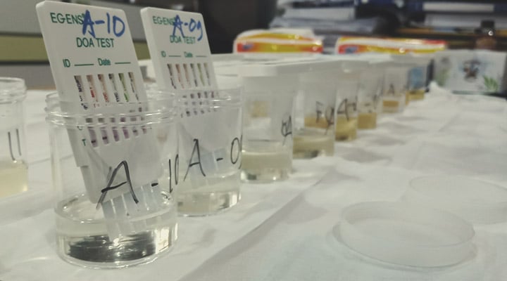 How Long Is THC Detectable in the Body? How Long Is THC Detectable in the Body?