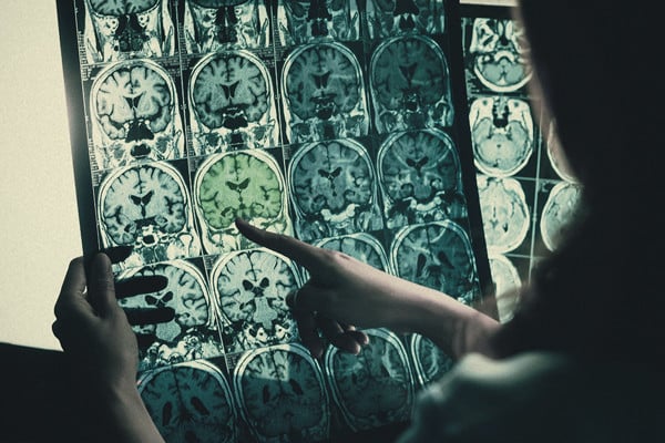 Is Cannabis Effective For People With Disabilities?