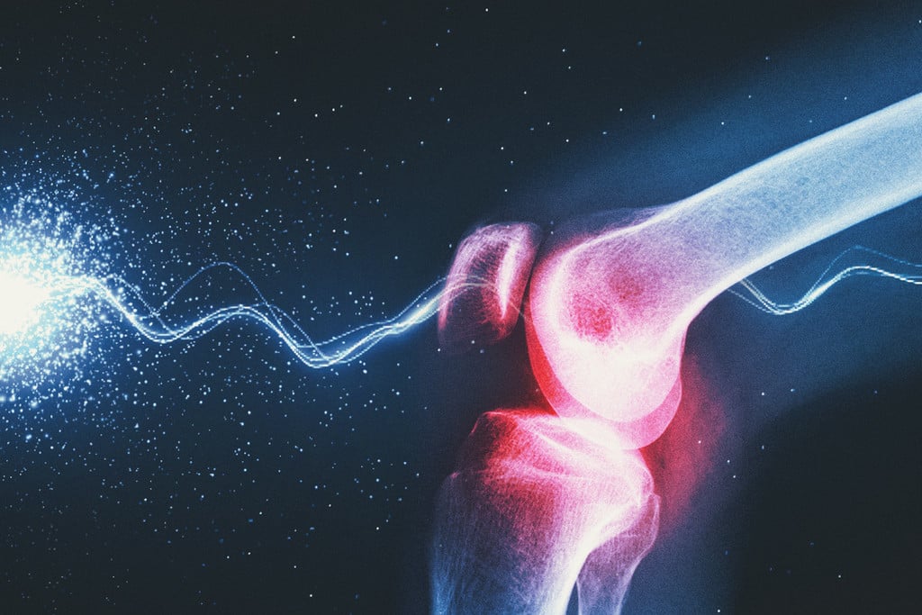 Can Cannabis Reduce Arthritis Pain and Inflammation?
