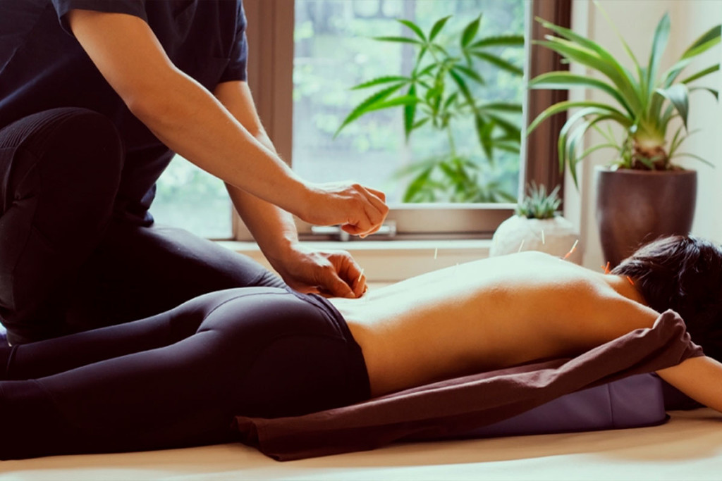 Cannabis And Acupuncture: A Double Boost For The Endocannabinoid System
