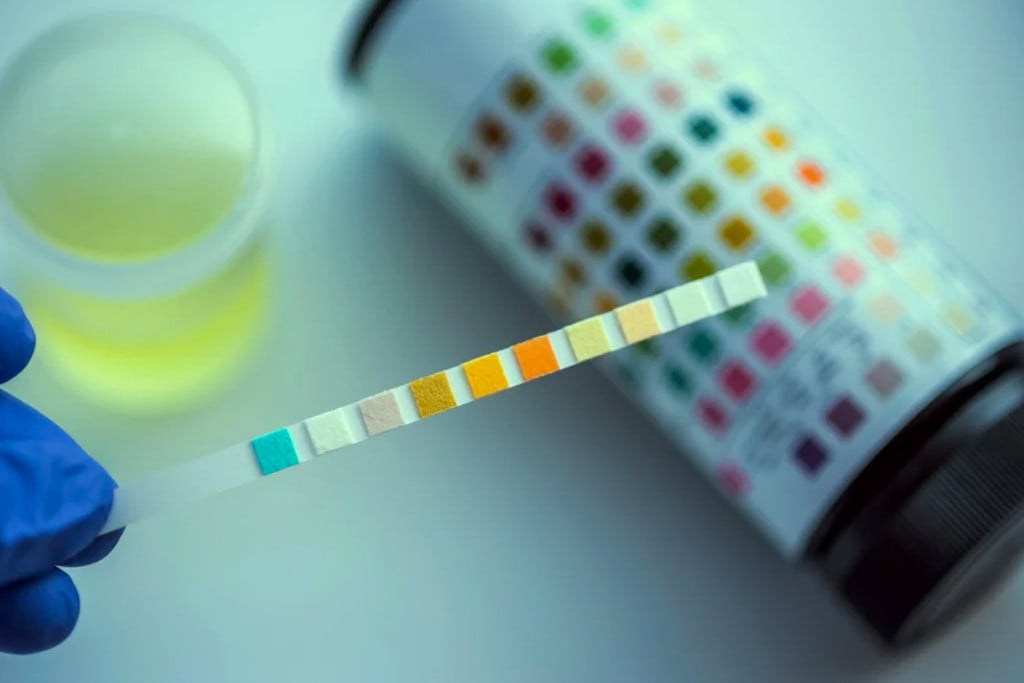 Will CBD Oil Trigger a Positive Drug Test?