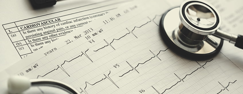 CBD and Cardiovascular Health CBD and Cardiovascular Health