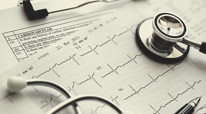 CBD and Cardiovascular Health CBD and Cardiovascular Health