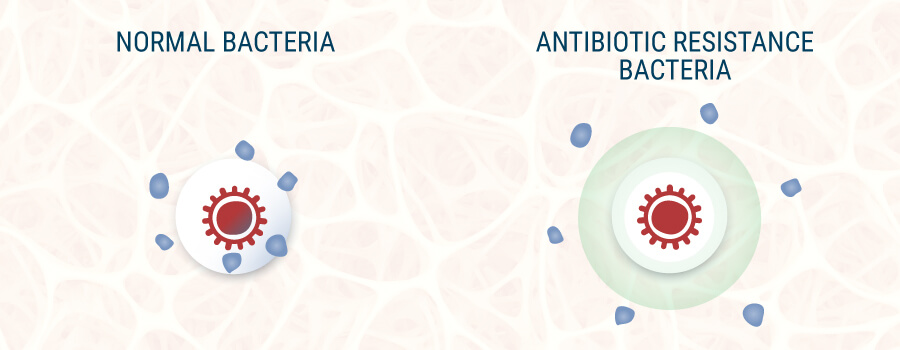 Normal Bacteria and Resistant Bacteria