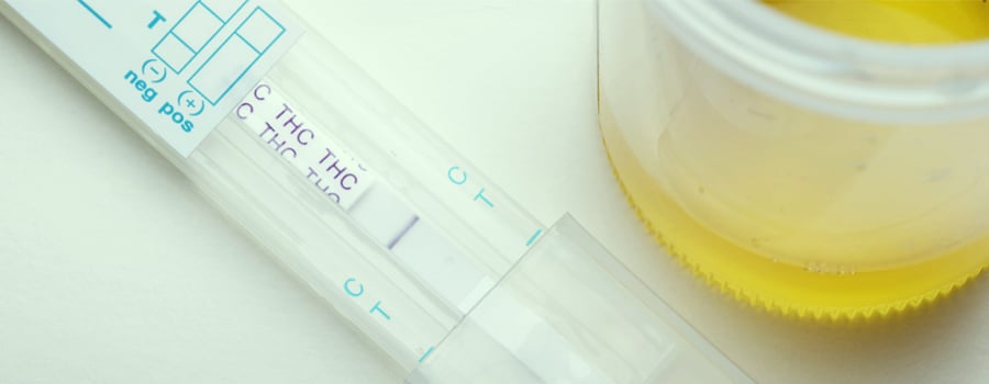 How Do Workplace Drug Tests Work?