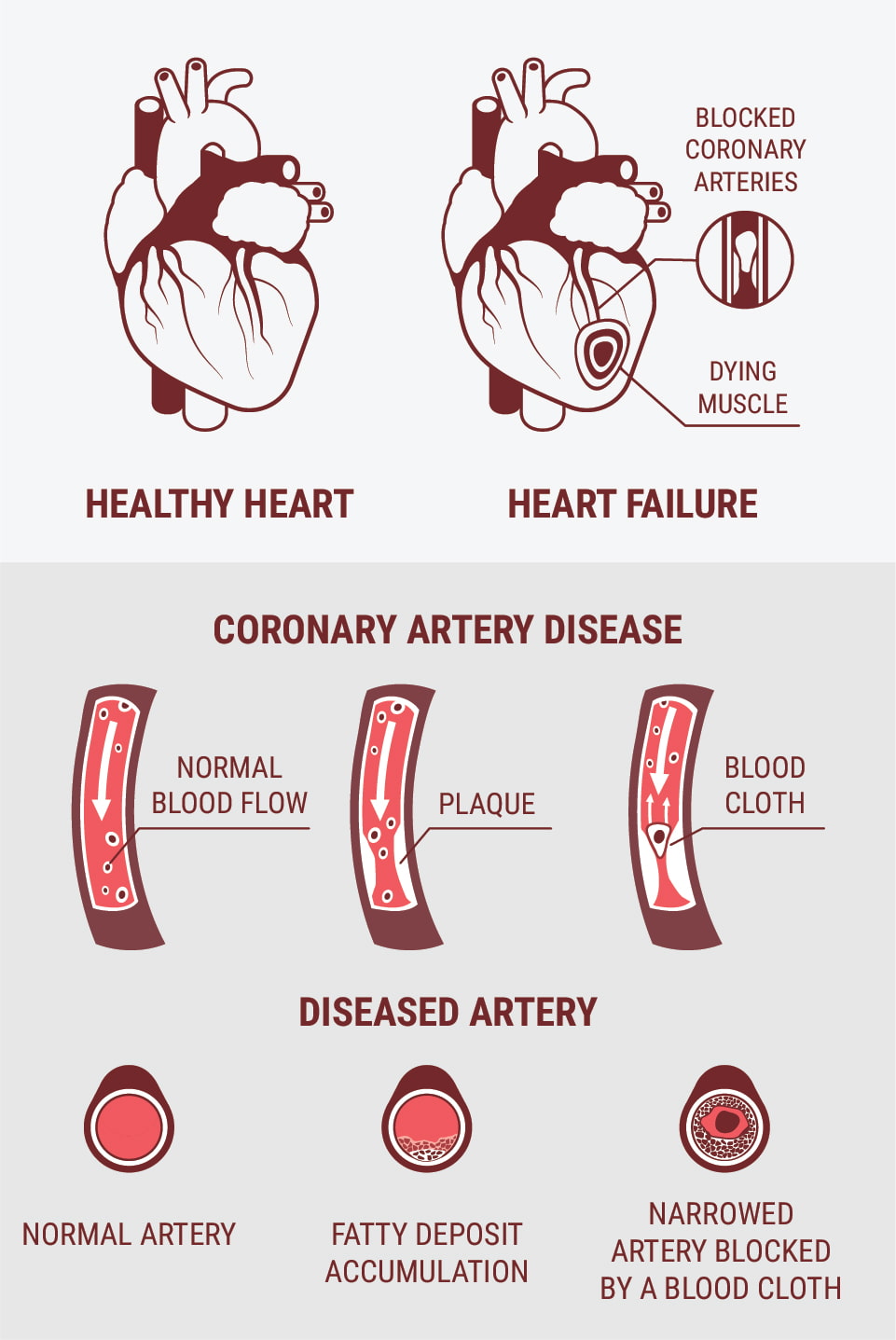 What Is Cardiovascular Disease (CVD)?
